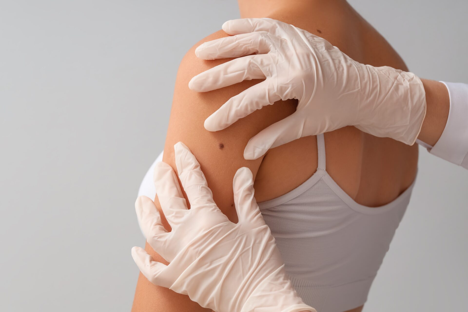 Médecin dermatologue qui examine la peau d'une patiente. Pour éviter un cancer de la peau. Mutuelle MCRN